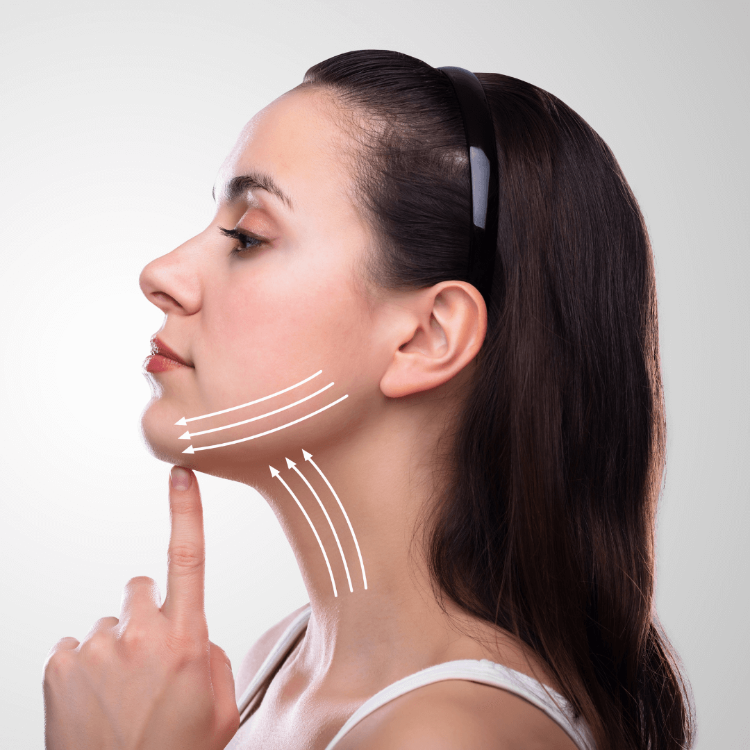 neck lift